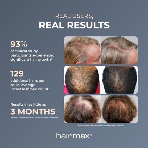 Hairmax ultima hair - hairmax,