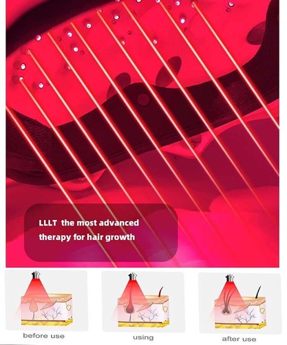 Best infared laser - infared, hair